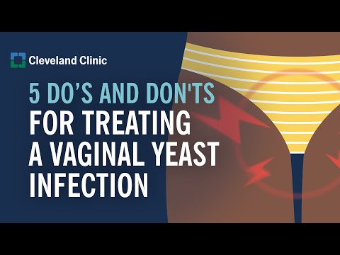 How to Treat a Yeast Infection